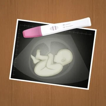 Echography and test pregnancy Stock Illustration