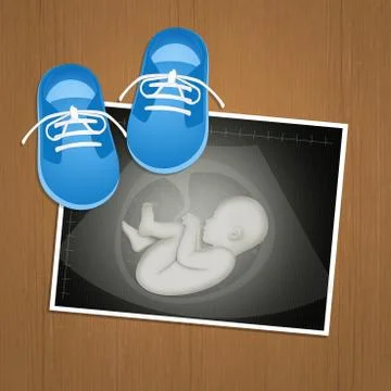 Echography of baby Stock Illustration