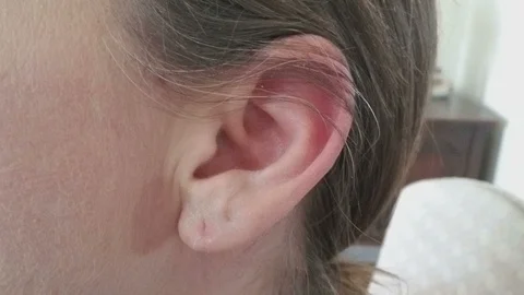 ECU of hand Covering Ear with Hand To Block Sound Видео 87025232