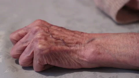 Eczema pain Stock Footage 135449009
