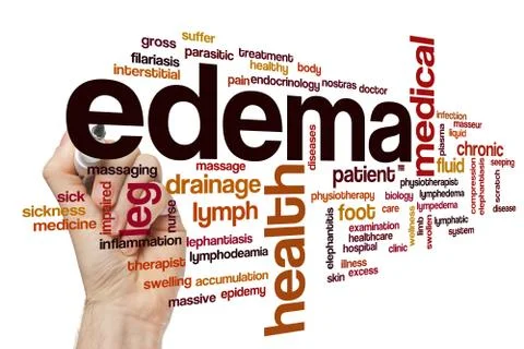 Edema Stock Illustration