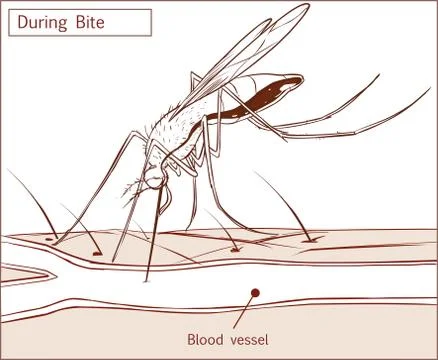 Editable vector illustration of a mosquito sucking blood from human skin Stock Illustration