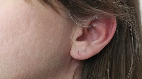 (Editorial) ECU of Cellphone Held to Ear Head Nodding Then Cellular Lowered (No Vidéo 87030533