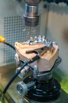 EDM machine for denture Stock-Fotos