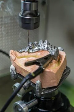 EDM machine for denture Foto stock