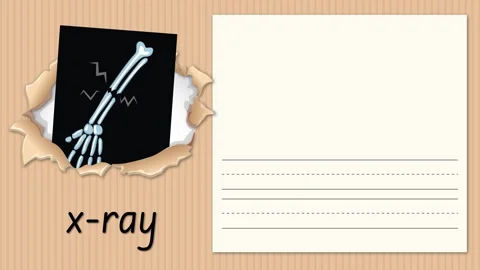 Educational Animation Teaching the Letter X with X-ray Illustration Stock Footage 330638372