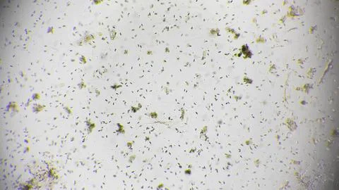 Educational microscopic image highlighting diverse algae and tiny particles Stock-Fotos