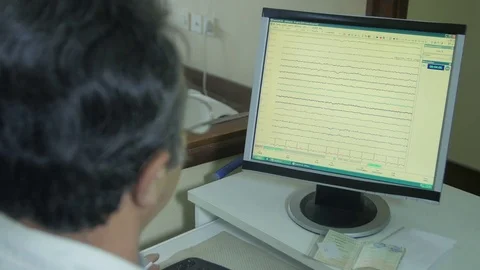 EEG diagnostic test, patient brain electrical activity graph on computer screen Stock Footage 75818476