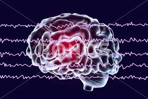 EEG Electroencephalogram, brain wave in awake state with mental activity Stock Illustration