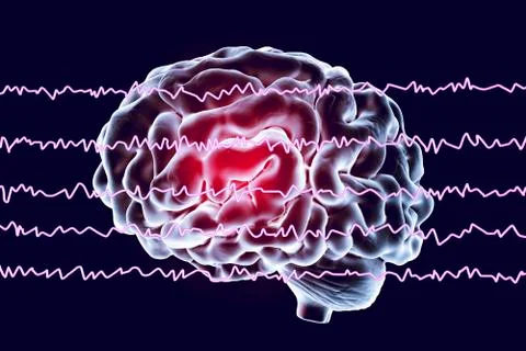 EEG Electroencephalogram, brain wave in awake state with mental activity Stock Illustration