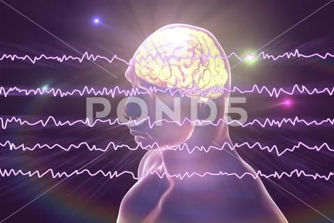EEG Electroencephalogram, brain wave in awake state with mental activity Stock Illustration
