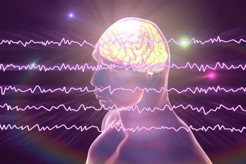 EEG Electroencephalogram, brain wave in awake state with mental activity Stock Illustration