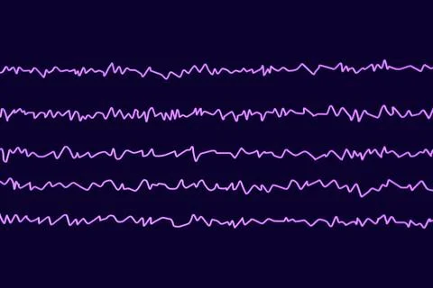 EEG Electroencephalogram, brain wave in awake state with mental activity Stock Illustration