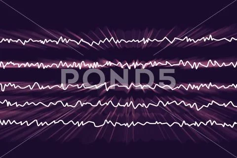 EEG Electroencephalogram, brain wave in awake state with mental activity Stock Illustration