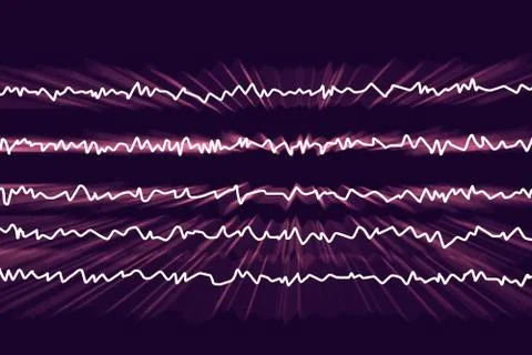 EEG Electroencephalogram, brain wave in awake state with mental activity Stock Illustration