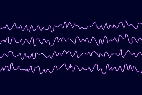 EEG Electroencephalogram, brain wave in awake state during rest Stock Illustration
