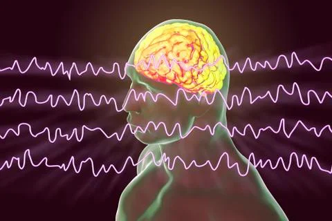 EEG Electroencephalogram, brain wave in awake state during rest Stock Illustration