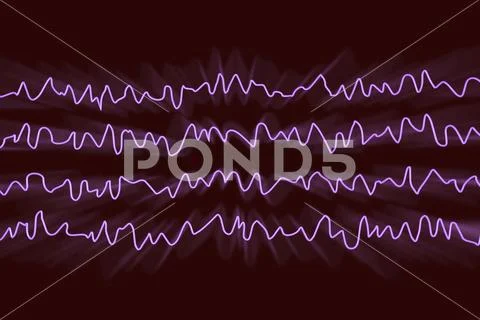 EEG Electroencephalogram, brain wave in awake state during rest Stock Illustration