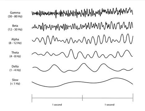 EEG (electroencephalogram) waveforms. Stock Illustration