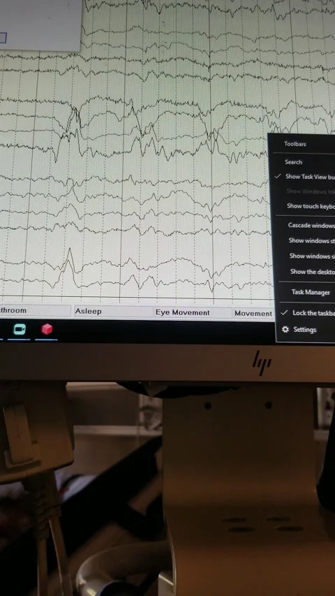 EEG Showing Brainwave Tracings from Multiple Leads Stock Footage 144509352