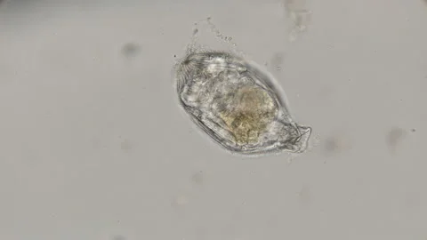 Egg creeping Rotatoria under a microscope Stock Footage 92053751