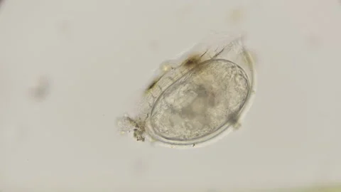 Egg creeping Rotatoria under a microscope Stock Footage 93578270