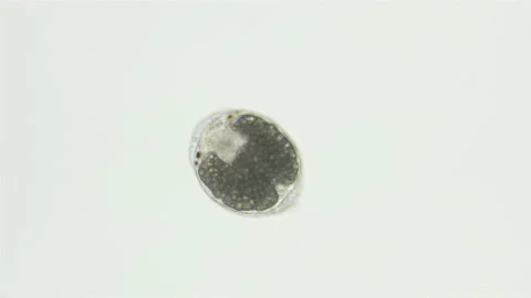 Egg with larva inside water mites Hydrachnidia under a microscope Stock Footage 161629790