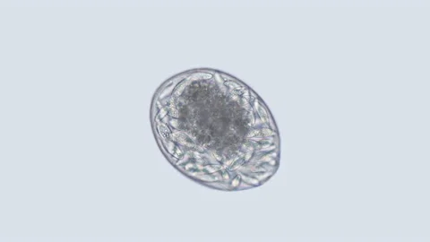 Egg Mollusca Nudibranchia under a microscope, possibly Superfamily Fionoidea Stock Footage 160953551
