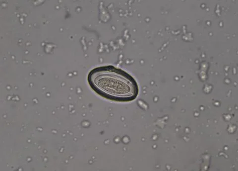 Egg of parasite in stool examition testing. Photos