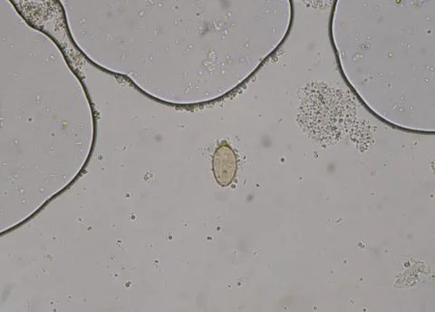 Egg of parasite in stool examition testing. Photos