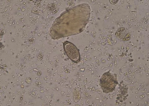 Egg of parasite in stool examition testing. Stockfoto's