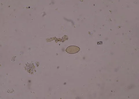 Egg of parasite in stool examition testing. Photos