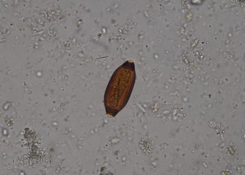 Egg of parasite in stool examition testing. Photos