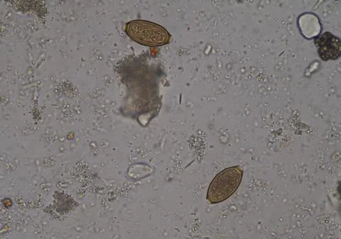 Egg of parasite in stool examition testing. Photos