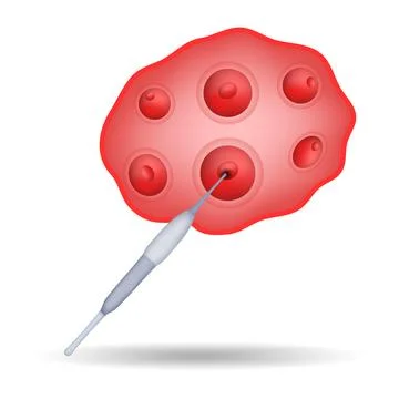 Egg retrieval procedure for IVF and assisted reproduction Stock Illustration