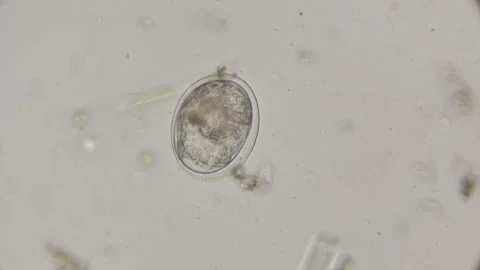 Egg Rotatoria ready to hatch, under a microscope Stock Footage 91919000