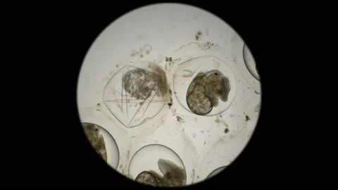 Eggs of Planorbis snails with already developed embryo and dead eggs, infected Stock Footage 91311274