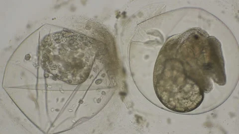 Eggs of Planorbis snails with already developed embryo and dead eggs, infected Stock Footage 91312355