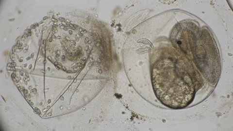 Eggs of Planorbis snails with already developed embryo and dead eggs, infected Stock Footage 91314088