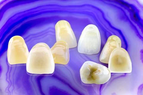 Eight ceramic dentures Stock Photos