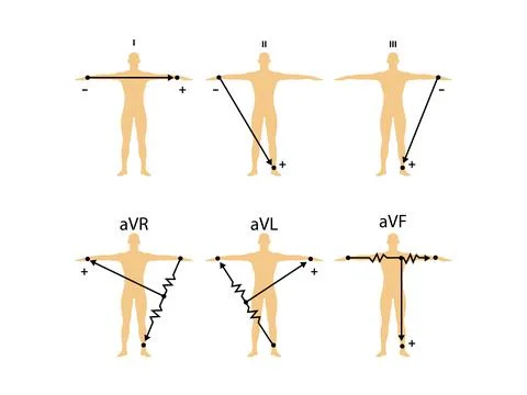 Einthoven ECG triangle, including augmented unipolar limb lead Stock Illustration