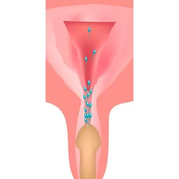 Ejaculation. Ejaculation into the genital tract. The structure of the uterus and Stock Illustration