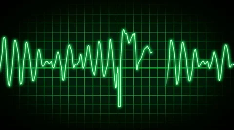 EKG 2420 Stock Footage 10867578