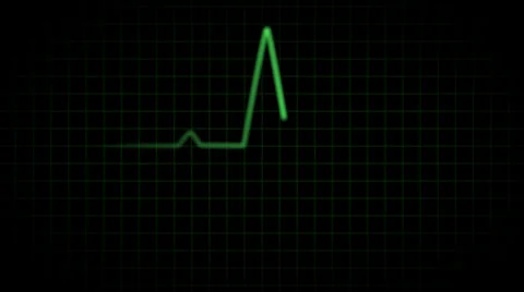 EKG with beeps Stock Footage 34039277