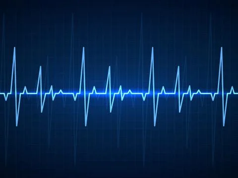 Ekg. Blue sinusoidal pulse lines, monitor with heartbeat signal. Cardiogram Stock Illustration