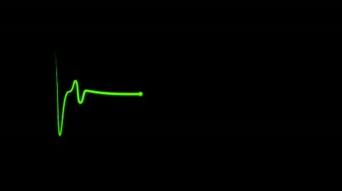 EKG - Electrocardiogram Vídeo Stock 605757
