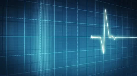 EKG electrocardiogram pulse trace Stock Footage 10767893