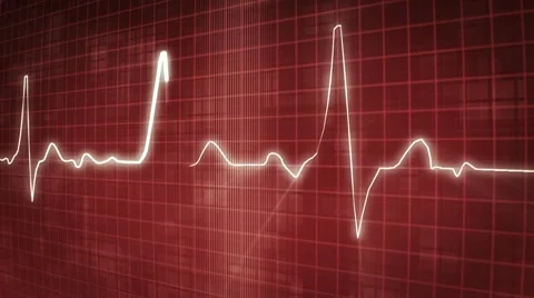 EKG electrocardiogram pulse trace Stock Footage 10767925