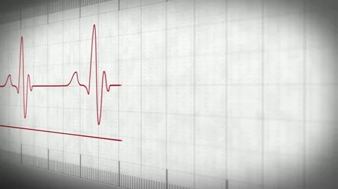 EKG electrocardiogram pulse trace Stock Footage 10808171