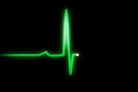EKG Flatlines NTSC Stock Footage 25855398